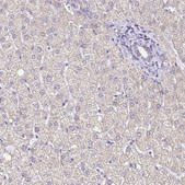 Anti-GABBR2 antibody produced in rabbit Prestige Antibodies® Powered by Atlas Antibodies, affinity isolated antibody, buffered aqueous glycerol solution