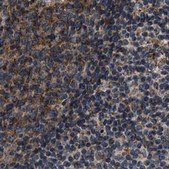 Anti-KTN1 antibody produced in rabbit Prestige Antibodies&#174; Powered by Atlas Antibodies, affinity isolated antibody, buffered aqueous glycerol solution