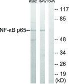 Anti-NF-&#954;B p65 antibody produced in rabbit affinity isolated antibody