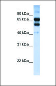 Anti-RARG antibody produced in rabbit affinity isolated antibody
