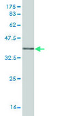Monoclonal Anti-MMP13 antibody produced in mouse clone 3B11, purified immunoglobulin, buffered aqueous solution