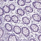 Anti-SPAG6 antibody produced in rabbit Prestige Antibodies&#174; Powered by Atlas Antibodies, affinity isolated antibody, buffered aqueous glycerol solution