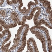 Anti-ZCCHC8 antibody produced in rabbit Prestige Antibodies&#174; Powered by Atlas Antibodies, affinity isolated antibody, buffered aqueous glycerol solution