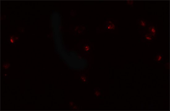Anti-CRIM1 antibody produced in rabbit affinity isolated antibody, buffered aqueous solution