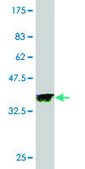 Monoclonal Anti-PAK3 antibody produced in mouse clone 3A12, purified immunoglobulin, buffered aqueous solution