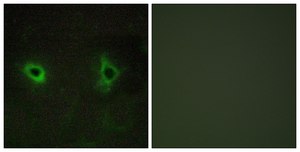 Anti-Collagen IV α3 antibody produced in rabbit affinity isolated antibody