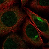 Anti-PKN2 antibody produced in rabbit Prestige Antibodies&#174; Powered by Atlas Antibodies, affinity isolated antibody