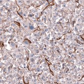 Anti-MCAM antibody produced in mouse Prestige Antibodies&#174; Powered by Atlas Antibodies, clone CL12855, purified by using Protein A, buffered aqueous glycerol solution