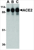 Anti-ACE2 antibody produced in rabbit affinity isolated antibody, buffered aqueous solution