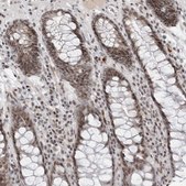 Anti-TRIM66 antibody produced in rabbit Prestige Antibodies® Powered by Atlas Antibodies, affinity isolated antibody, buffered aqueous glycerol solution