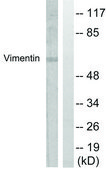 Anti-Vimentin antibody produced in rabbit affinity isolated antibody