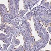 Anti-FAM166B antibody produced in rabbit Prestige Antibodies&#174; Powered by Atlas Antibodies, affinity isolated antibody, buffered aqueous glycerol solution