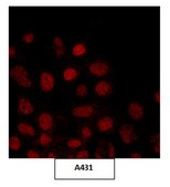 Anti-JHDM1B Antibody from rabbit, purified by affinity chromatography
