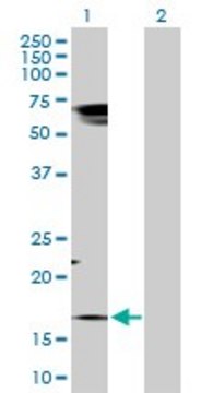 Anti-TAC1 antibody produced in rabbit purified immunoglobulin, buffered aqueous solution