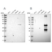 Anti-CYP2C8 antibody produced in rabbit Prestige Antibodies&#174; Powered by Atlas Antibodies, affinity isolated antibody, buffered aqueous glycerol solution