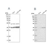 Anti-PDHB antibody produced in rabbit Prestige Antibodies&#174; Powered by Atlas Antibodies, affinity isolated antibody, buffered aqueous glycerol solution