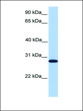 Anti-CDKN3 antibody produced in rabbit affinity isolated antibody