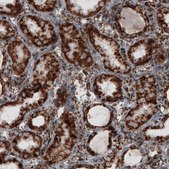 Monoclonal Anti-TUFM antibody produced in mouse Prestige Antibodies&#174; Powered by Atlas Antibodies, clone CL2245, purified immunoglobulin, buffered aqueous glycerol solution