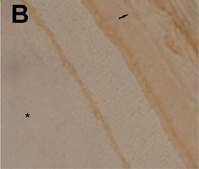 Anti-Na+K+ ATPase &#945;-2 Antibody serum, Upstate&#174;