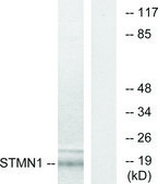 Anti-Stathmin 1 antibody produced in rabbit affinity isolated antibody
