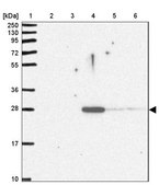 Anti-APCS antibody produced in rabbit Prestige Antibodies&#174; Powered by Atlas Antibodies, affinity isolated antibody, buffered aqueous glycerol solution