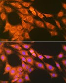 Anti-PGE receptor EP2 (PTGER2) antibody produced in rabbit