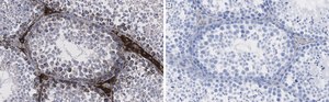 Anti-IDH1 Antibody, clone 1M9 ZooMAb® Rabbit Monoclonal recombinant, expressed in HEK 293 cells