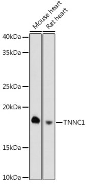 Anti-TNNC1 Antibody, clone 8Z4V9, Rabbit Monoclonal