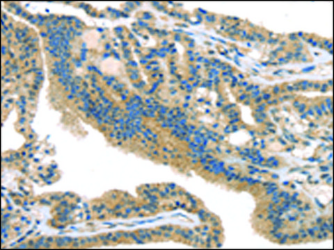 Anti-SMYD3 affinity isolated antibody