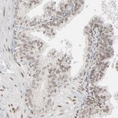 Anti-CUX1 antibody produced in rabbit Prestige Antibodies&#174; Powered by Atlas Antibodies, affinity isolated antibody, buffered aqueous glycerol solution