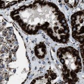 Anti-MDH2 antibody produced in rabbit Prestige Antibodies&#174; Powered by Atlas Antibodies, affinity isolated antibody, buffered aqueous glycerol solution