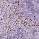 Anti-CXCR2 antibody produced in rabbit Prestige Antibodies&#174; Powered by Atlas Antibodies, affinity isolated antibody, buffered aqueous glycerol solution