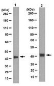 Anti-SERPINB5 Antibody, clone 5C6.2 clone 5C6.2, from mouse