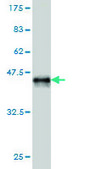 Monoclonal Anti-TIAM2 antibody produced in mouse clone 3C1, purified immunoglobulin, buffered aqueous solution