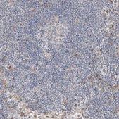 Anti-CMTM4 antibody produced in rabbit Prestige Antibodies&#174; Powered by Atlas Antibodies, affinity isolated antibody, buffered aqueous glycerol solution
