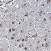 Anti-LTA antibody produced in rabbit Prestige Antibodies&#174; Powered by Atlas Antibodies, affinity isolated antibody, buffered aqueous glycerol solution