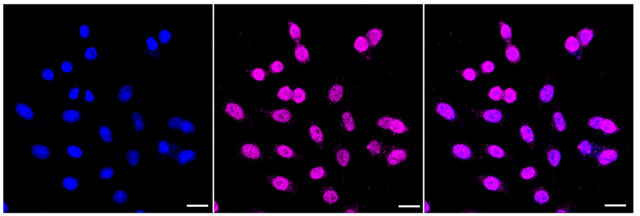 KD-Validated Anti AP1G1 Antibody, clone 23GB3655, Rabbit Monoclonal clone 23GB3655, recombinant rabbit monoclonal, expressed in HEK293 cells