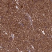 Anti-DNM1L antibody produced in rabbit Prestige Antibodies&#174; Powered by Atlas Antibodies, affinity isolated antibody, buffered aqueous glycerol solution