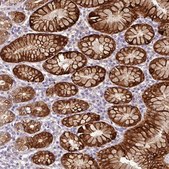 Anti-CTSE antibody produced in rabbit Prestige Antibodies&#174; Powered by Atlas Antibodies, affinity isolated antibody, buffered aqueous glycerol solution