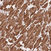Anti-HRC antibody produced in rabbit Prestige Antibodies&#174; Powered by Atlas Antibodies, affinity isolated antibody, buffered aqueous glycerol solution