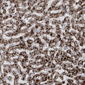 Anti-ABCD3 antibody produced in rabbit Prestige Antibodies&#174; Powered by Atlas Antibodies, affinity isolated antibody, buffered aqueous glycerol solution