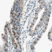 Anti-CDH6 antibody produced in rabbit Ab1, Prestige Antibodies&#174; Powered by Atlas Antibodies, affinity isolated antibody, buffered aqueous glycerol solution