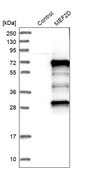 Anti-MEF2D antibody produced in rabbit Ab1, Prestige Antibodies&#174; Powered by Atlas Antibodies, affinity isolated antibody, buffered aqueous glycerol solution