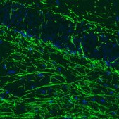 Monoclonal Anti-MBP antibody produced in mouse Prestige Antibodies&#174; Powered by Atlas Antibodies, clone CL2829, purified immunoglobulin, buffered aqueous glycerol solution