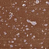 Anti-GNAO1 antibody produced in rabbit Prestige Antibodies&#174; Powered by Atlas Antibodies, affinity isolated antibody, buffered aqueous glycerol solution