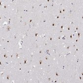 Anti-HNRNPA0 antibody produced in rabbit Prestige Antibodies&#174; Powered by Atlas Antibodies, affinity isolated antibody