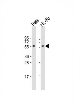 [KO Validated]Anti-Presenilin 1 antibody produced in rabbit [Knockout Validated],purified polyclonal antibody, buffered aqueous solution