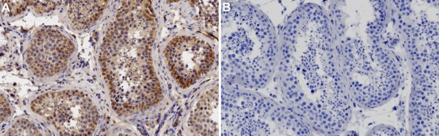 Anti-Vimentin Antibody, clone LN-6 culture supernatant, clone LN-6, Chemicon&#174;
