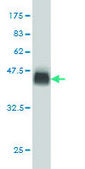 Monoclonal Anti-USP9X antibody produced in mouse clone 1C4, purified immunoglobulin, buffered aqueous solution