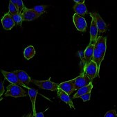 Anti-Dynein Antibody, IC, cytosolic, clone 74.1, Alexa Fluor&#8482; 647 conjugate clone 74.1, from mouse, ALEXA FLUOR&#8482; 647